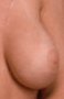 image\l_breast.jpg